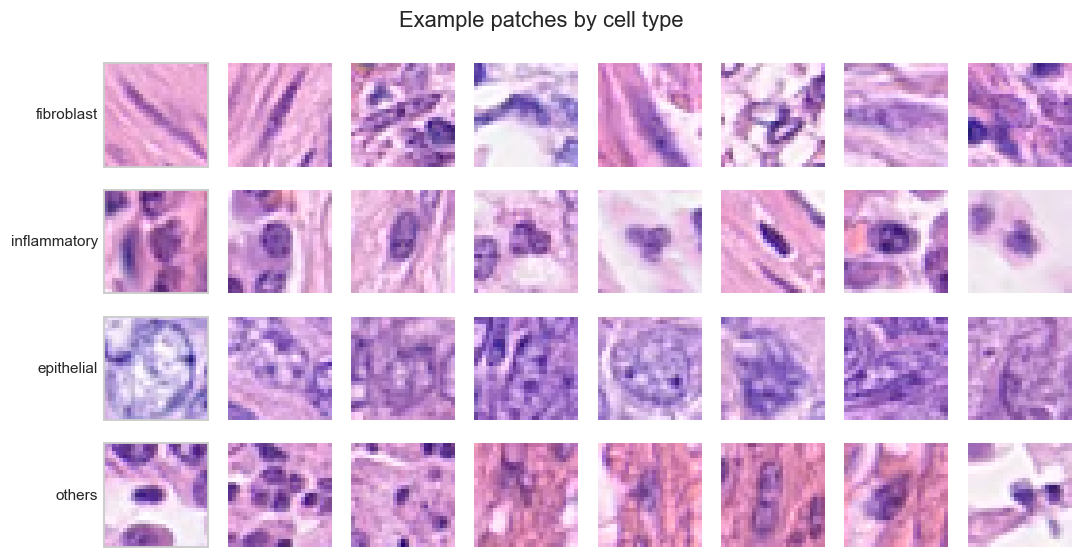 Colon Cancer Cell Classifier — CNN on Tissue Images — screenshot